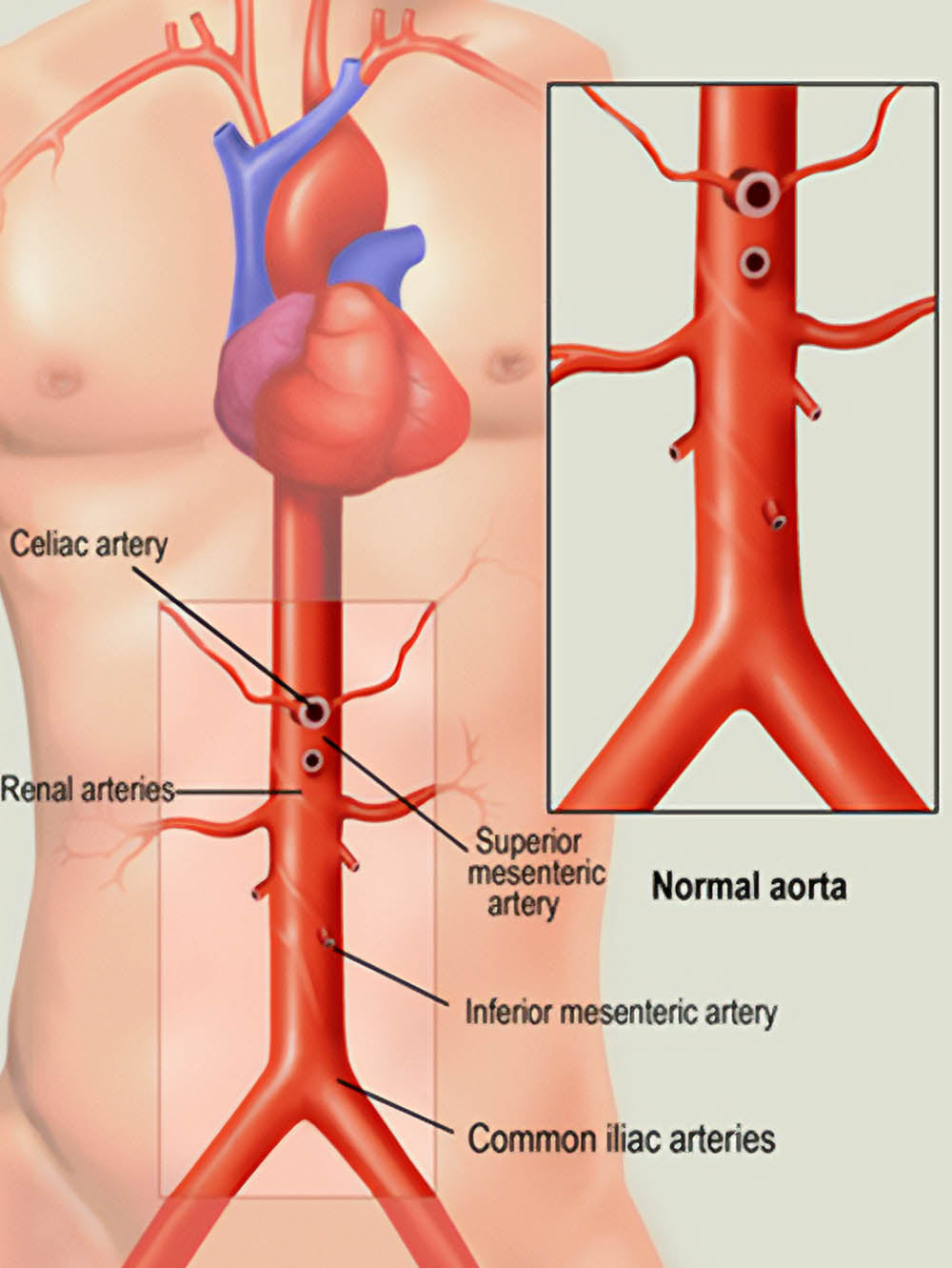 Hire a Medical Illustrator